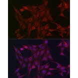 Immunofluorescence - Anti-STAT3 Antibody (A13365) - Antibodies.com