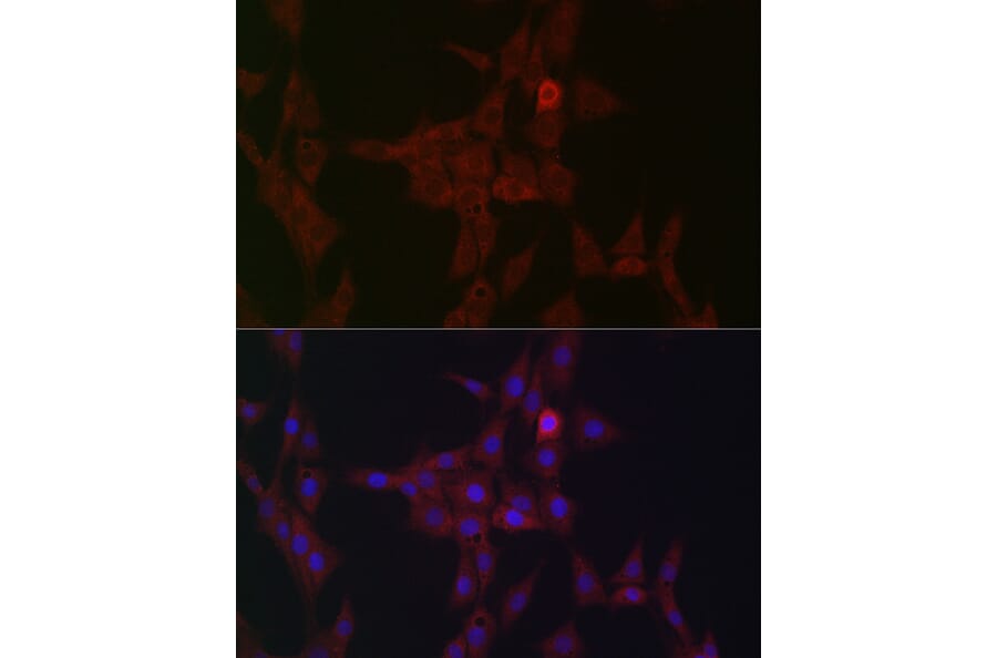 Immunofluorescence - Anti-STAT3 Antibody (A13365) - Antibodies.com