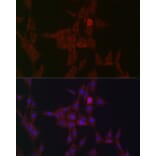 Immunofluorescence - Anti-STAT3 Antibody (A13365) - Antibodies.com