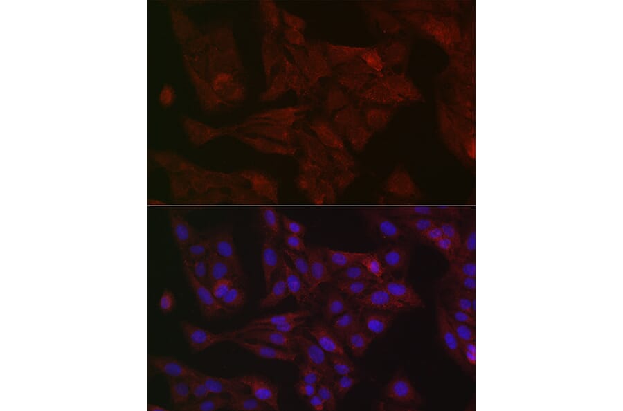 Immunofluorescence - Anti-STAT3 Antibody (A13365) - Antibodies.com
