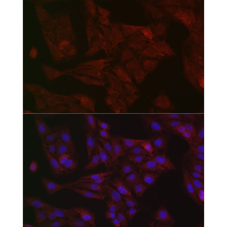 Immunofluorescence - Anti-STAT3 Antibody (A13365) - Antibodies.com