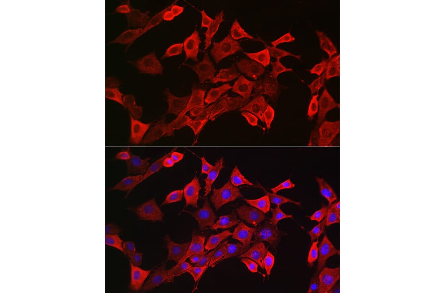 Immunofluorescence - Anti-STAT3 Antibody (A13365) - Antibodies.com