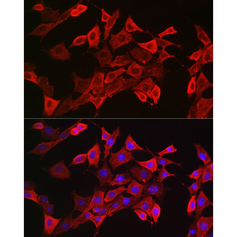 Immunofluorescence - Anti-STAT3 Antibody (A13365) - Antibodies.com