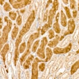 Immunohistochemistry - Anti-HGF Antibody (A13366) - Antibodies.com