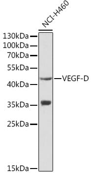 Western blot analysis of extracts of NCI-H460 cells, using Anti-FIGF Antibody (A1194) at 1:1,000 dilution.
Secondary antibody: Goat Anti-Rabbit IgG (H+L) (HRP) (AS014) at 1:10,000 dilution.
Lysates / proteins: 25µg per lane.
Blocking buffer: 3% non-fat dry milk in TBST.