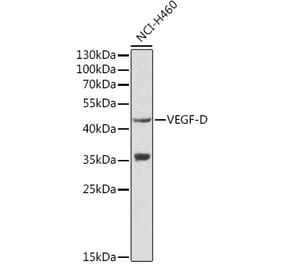 Western Blot - Anti-VEGFD Antibody (A13367) - Antibodies.com