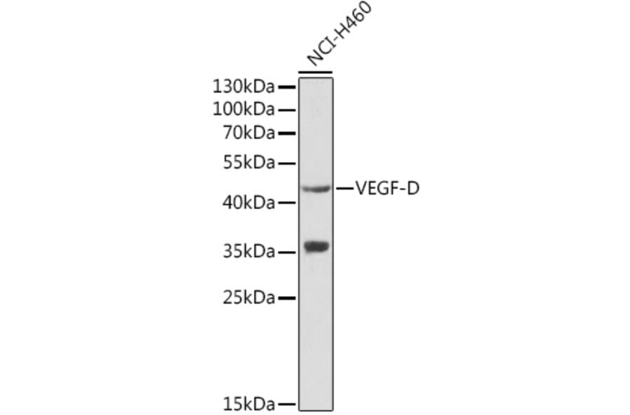 Western Blot - Anti-VEGFD Antibody (A13367) - Antibodies.com