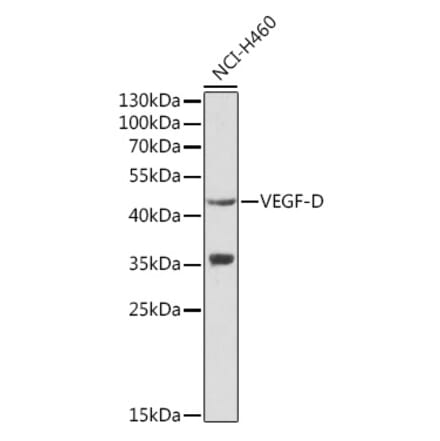 Western Blot - Anti-VEGFD Antibody (A13367) - Antibodies.com