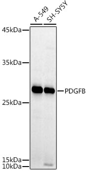 Western blot analysis of extracts of various cell lines, using Anti-PDGFB Antibody (A1195) at 1:1,000 dilution.
Secondary antibody: Goat Anti-Rabbit IgG (H+L) (HRP) (AS014) at 1:10,000 dilution.
Lysates / proteins: 25µg per lane.
Blocking buffer: 3% non-fat dry milk in TBST.