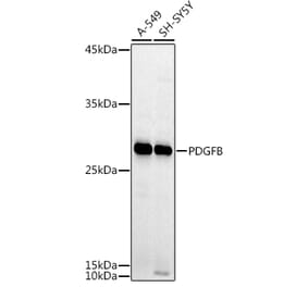 Western Blot - Anti-PDGF B Antibody (A13368) - Antibodies.com