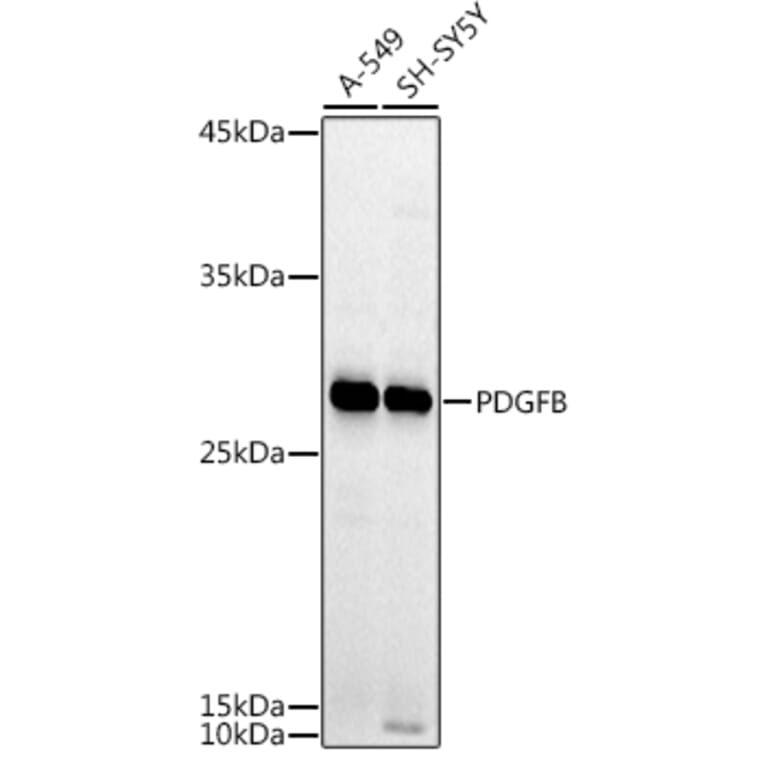 Western Blot - Anti-PDGF B Antibody (A13368) - Antibodies.com