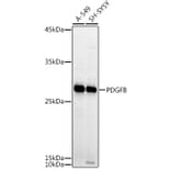 Western Blot - Anti-PDGF B Antibody (A13368) - Antibodies.com