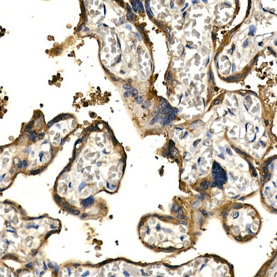 Immunohistochemistry of paraffin-embedded rat kidney using Anti-PDGFB Antibody (A1195) at dilution of 1:100 (40x lens).