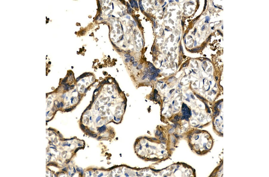 Immunohistochemistry - Anti-PDGF B Antibody (A13368) - Antibodies.com