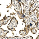 Immunohistochemistry - Anti-PDGF B Antibody (A13368) - Antibodies.com