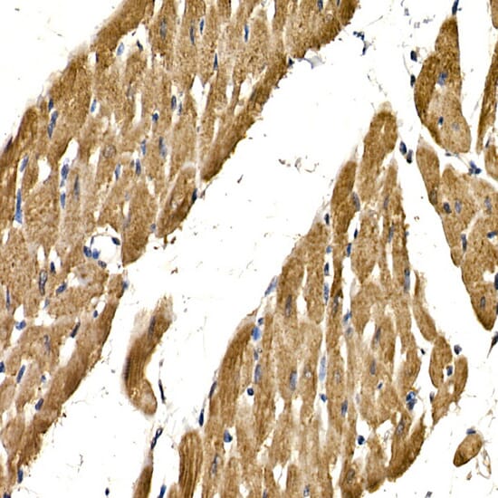 Immunohistochemistry of paraffin-embedded human colon using Anti-PDGFB Antibody (A1195) at dilution of 1:100 (40x lens).