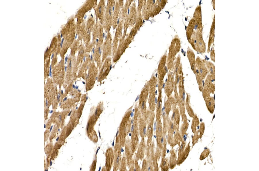 Immunohistochemistry - Anti-PDGF B Antibody (A13368) - Antibodies.com