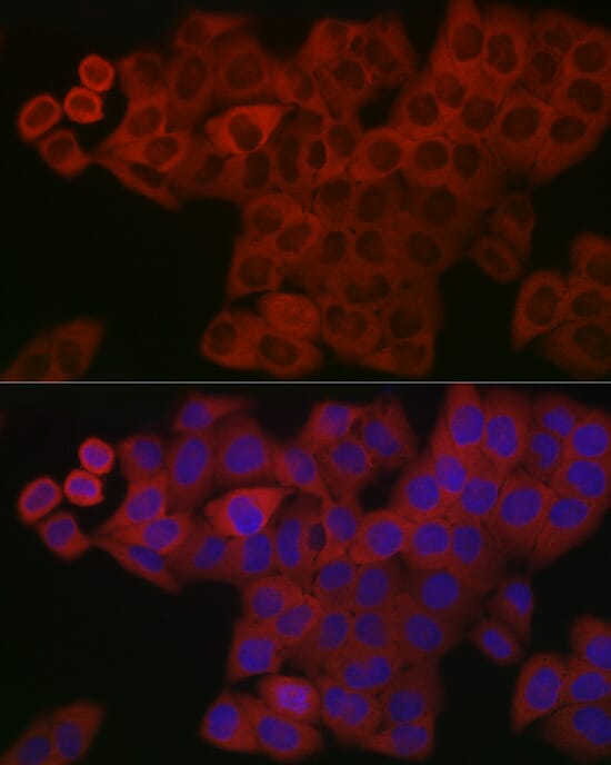 Immunohistochemistry of paraffin-embedded human esophagus using Anti-PDGFB Antibody (A1195) at dilution of 1:100 (40x lens).
