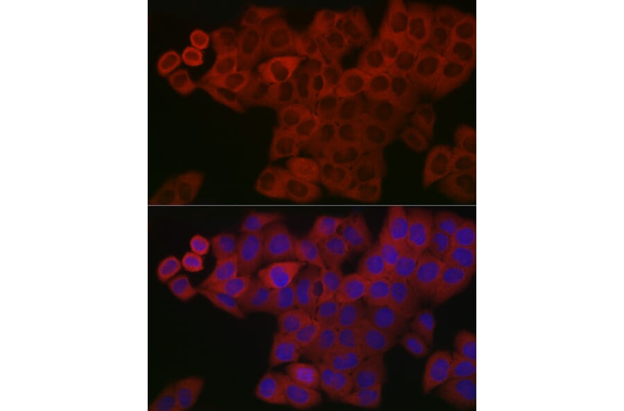 Immunofluorescence - Anti-PDGF B Antibody (A13368) - Antibodies.com