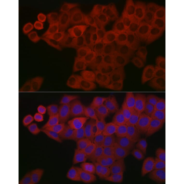 Immunofluorescence - Anti-PDGF B Antibody (A13368) - Antibodies.com