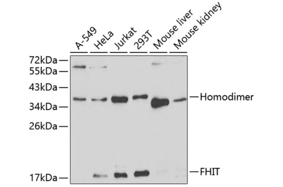 Western Blot - Anti-FHIT Antibody (A13369) - Antibodies.com