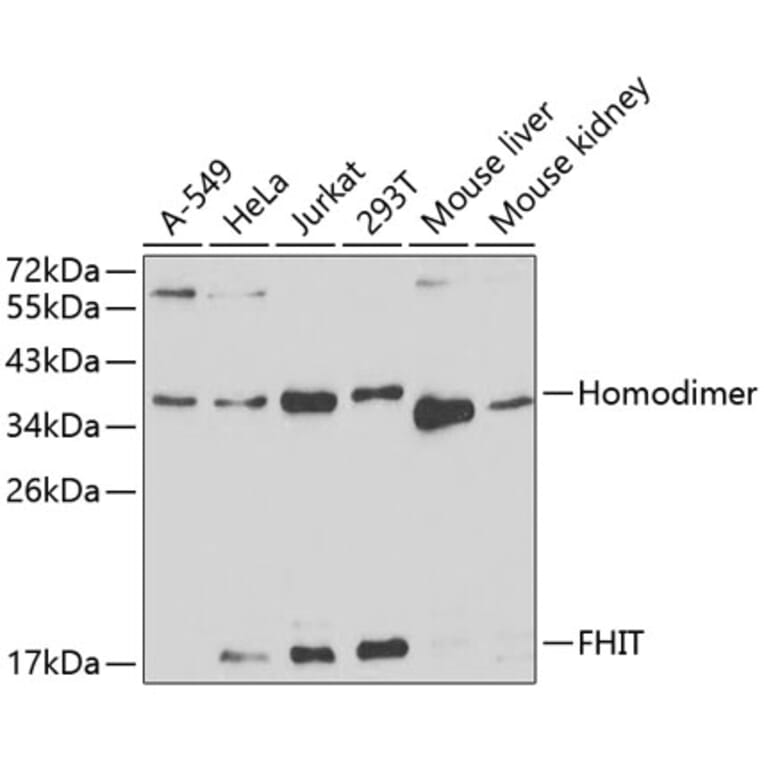 Western Blot - Anti-FHIT Antibody (A13369) - Antibodies.com