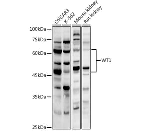 Western Blot - Anti-Wilms Tumor Protein Antibody (A13370) - Antibodies.com