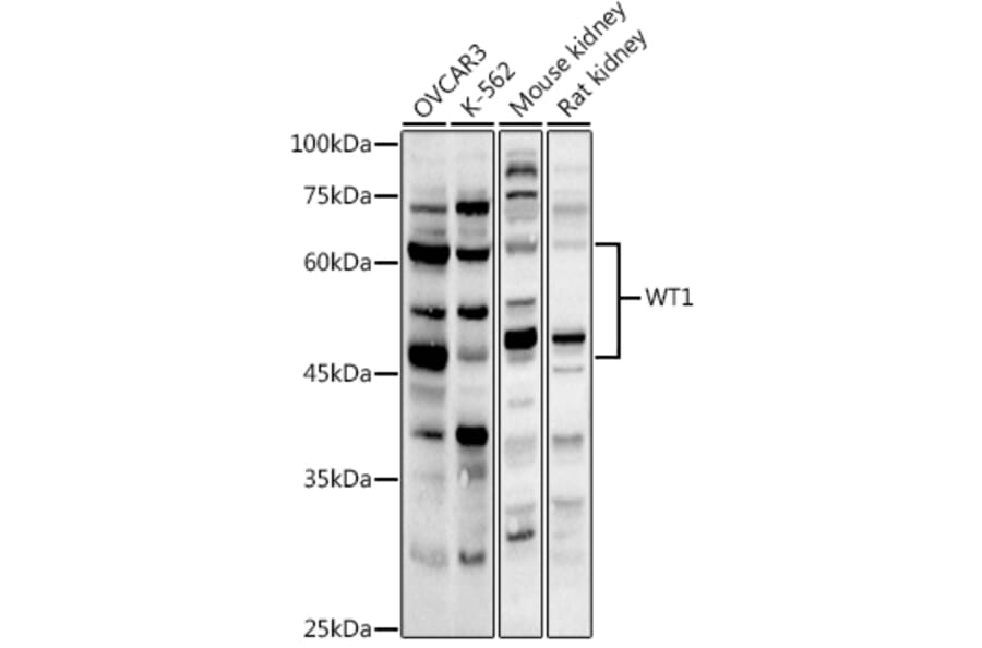 Western Blot - Anti-Wilms Tumor Protein Antibody (A13370) - Antibodies.com