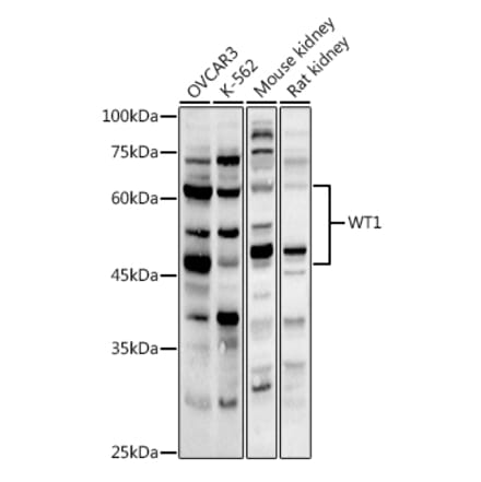 Western Blot - Anti-Wilms Tumor Protein Antibody (A13370) - Antibodies.com