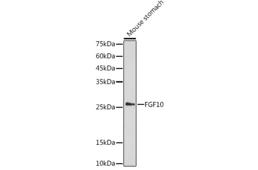 Western Blot - Anti-FGF10 Antibody (A13371) - Antibodies.com