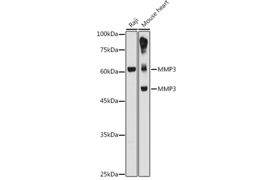 Western Blot - Anti-MMP3 Antibody (A13372) - Antibodies.com