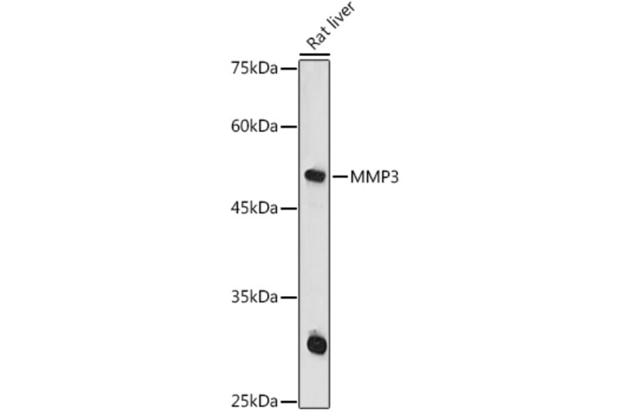 Western Blot - Anti-MMP3 Antibody (A13372) - Antibodies.com