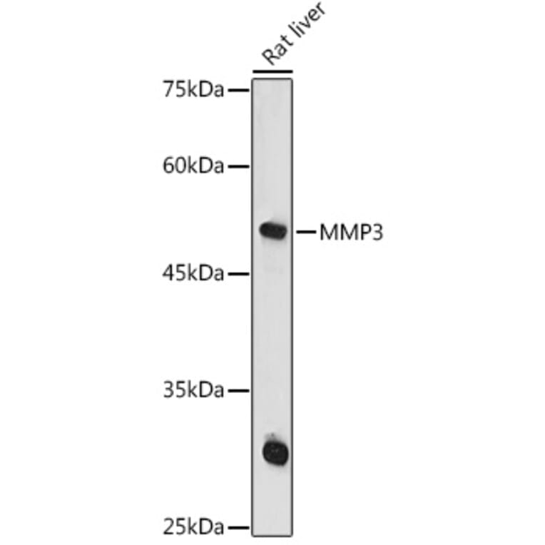 Western Blot - Anti-MMP3 Antibody (A13372) - Antibodies.com