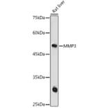 Western Blot - Anti-MMP3 Antibody (A13372) - Antibodies.com