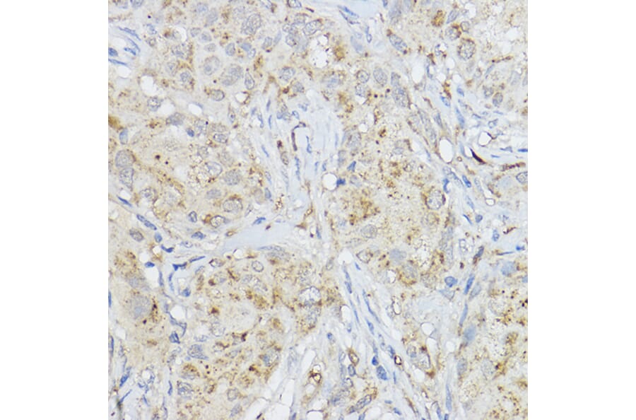 Immunohistochemistry - Anti-MMP3 Antibody (A13372) - Antibodies.com
