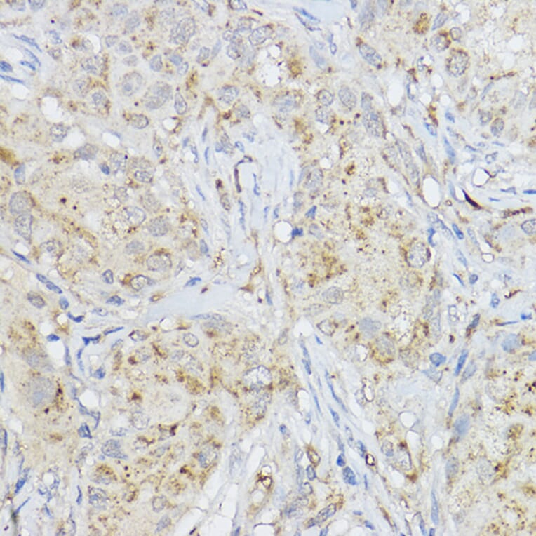 Immunohistochemistry - Anti-MMP3 Antibody (A13372) - Antibodies.com