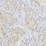 Immunohistochemistry - Anti-MMP3 Antibody (A13372) - Antibodies.com