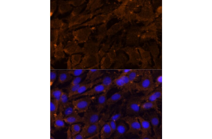 Immunofluorescence - Anti-MMP3 Antibody (A13372) - Antibodies.com