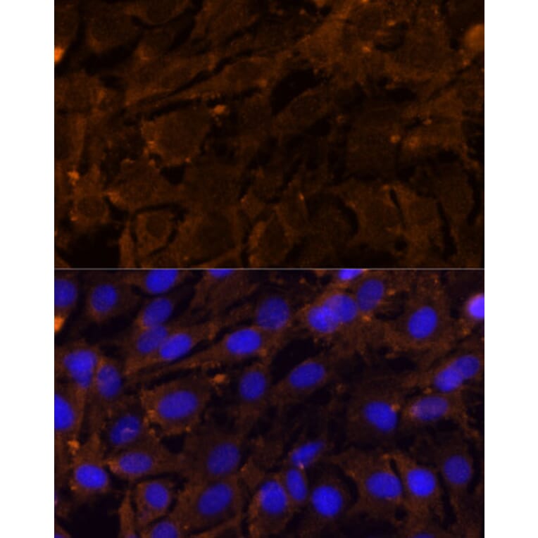 Immunofluorescence - Anti-MMP3 Antibody (A13372) - Antibodies.com