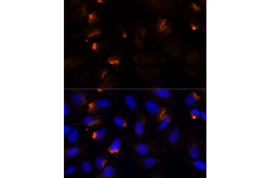 Immunofluorescence - Anti-MMP3 Antibody (A13372) - Antibodies.com