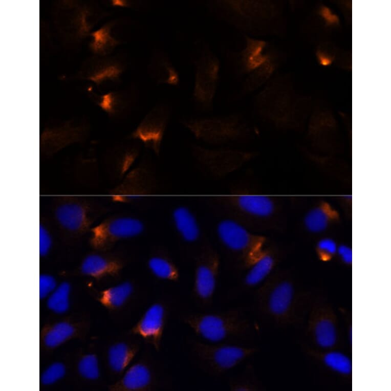 Immunofluorescence - Anti-MMP3 Antibody (A13372) - Antibodies.com