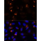 Immunofluorescence - Anti-MMP3 Antibody (A13372) - Antibodies.com