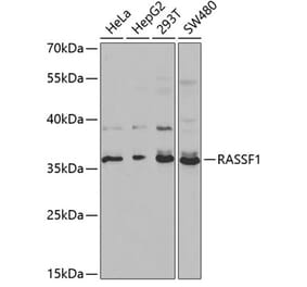 Western Blot - Anti-RASSF1 Antibody (A13373) - Antibodies.com