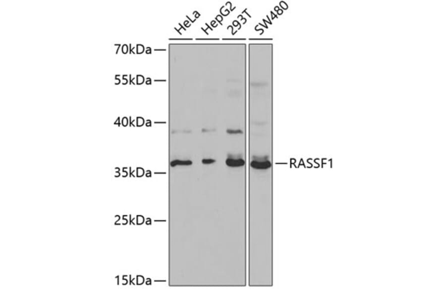 Western Blot - Anti-RASSF1 Antibody (A13373) - Antibodies.com