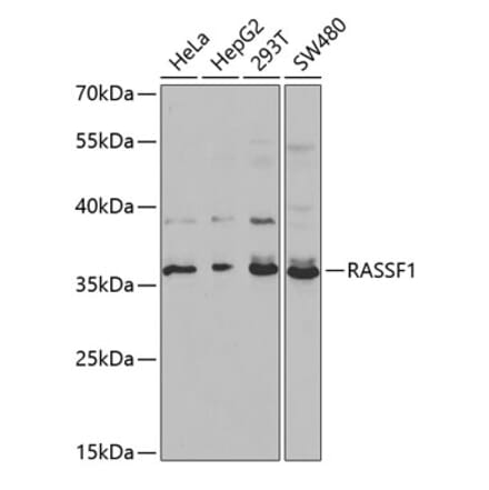Western Blot - Anti-RASSF1 Antibody (A13373) - Antibodies.com