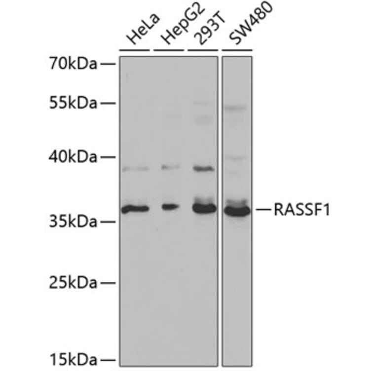 Western Blot - Anti-RASSF1 Antibody (A13373) - Antibodies.com