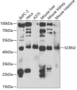 Western blot analysis of extracts of various cell lines, using Anti-SCRN2 Antibody (A1205) at 1:1,000 dilution.
Secondary antibody: Goat Anti-Rabbit IgG (H+L) (HRP) (AS014) at 1:10,000 dilution.
Lysates / proteins: 25µg per lane.
Blocking buffer: 3% non-fat dry milk in TBST.
