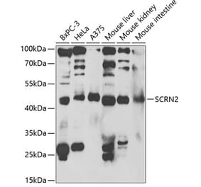 Western Blot - Anti-SCRN2 Antibody (A13374) - Antibodies.com