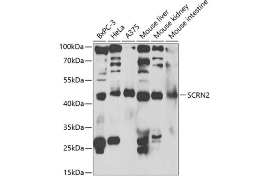 Western Blot - Anti-SCRN2 Antibody (A13374) - Antibodies.com