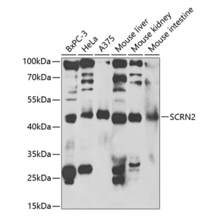 Western Blot - Anti-SCRN2 Antibody (A13374) - Antibodies.com